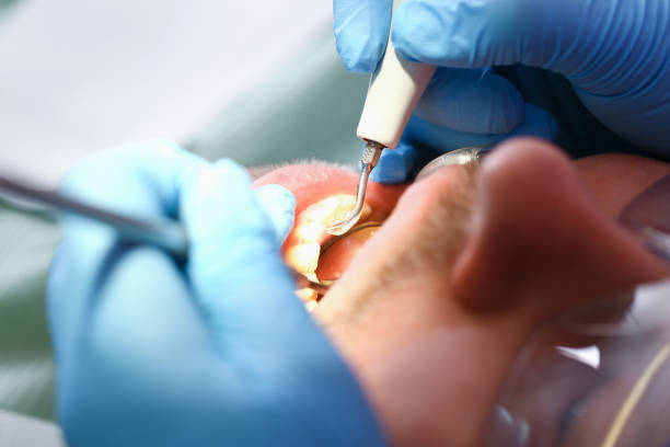 Best Weekend Emergency Dentist in Laguna Hills, CA