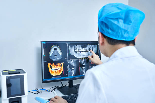Best Emergency Tooth Extraction in Laguna Hills, CA